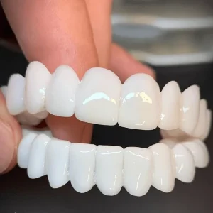 GLAMFANG – Vintage-Style Dental Grillz for Confident Smiles